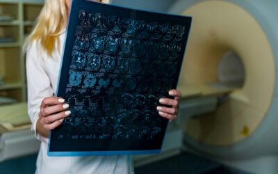 Kiedy tomografia z kontrastem jest zalecana przez lekarza?