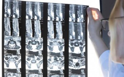 Co to jest kontrast w tomografii komputerowej i kiedy się go stosuje?