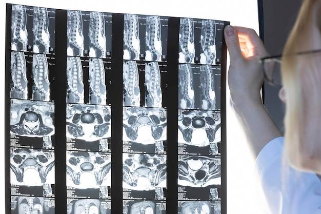 Co to jest kontrast w tomografii komputerowej i kiedy się go stosuje?