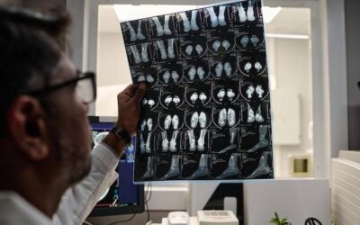 Po co oznacza się kreatyninę do tomografii?