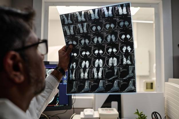 Po co oznacza się kreatyninę do tomografii?