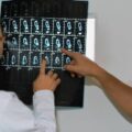Tomografia komputerowa kiedy wynik jest dostępny dla pacjenta?