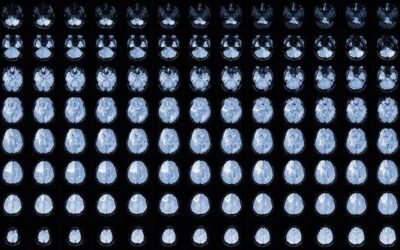 Tomografia z kontrastem jak wygląda takie badanie?