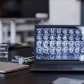 Ile się czeka na tomografię głowy w polskich placówkach?