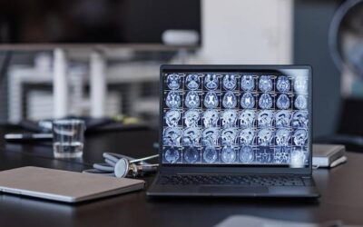 Ile się czeka na tomografię głowy w polskich placówkach?