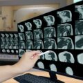Tomografia komputerowa zatok jak się przygotować do badania?
